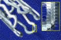 Photos in photos (stent)