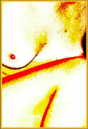 Figure-I