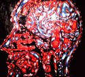 Cerebro